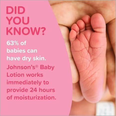JOHNSON BABY SOFT LOTION   -  300 ML