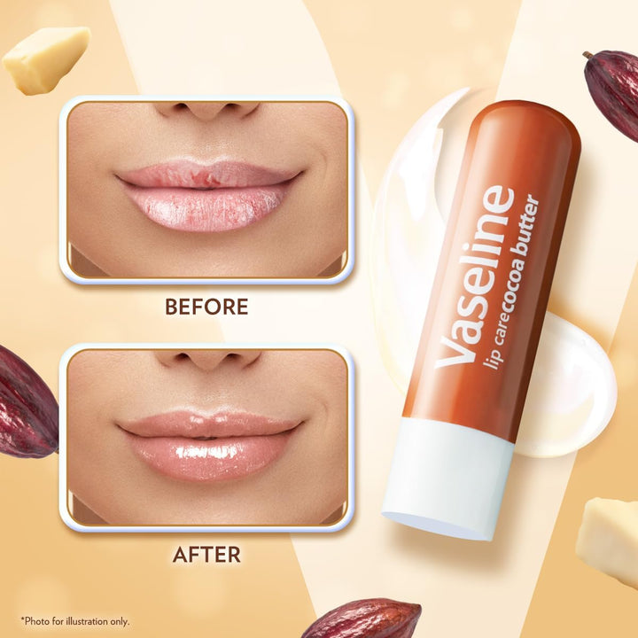 Vaseline Lip Therapy Cocoa Butter Lip Balm With Pure Jelly| Cocoa Butter & Shea Butter For Soft & Glowing Lips| Nourishes &