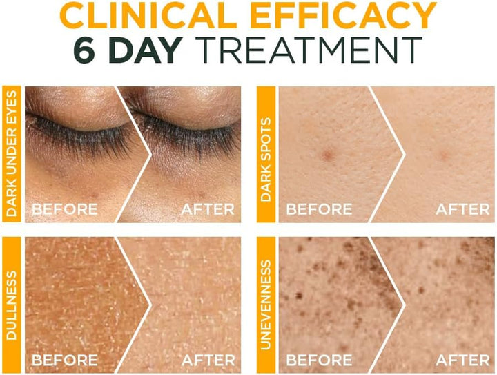 Fast Bright Vitamin C Brightening Ampoules For Dark Circles, Multipack, Hyperpigmentation Ampoules