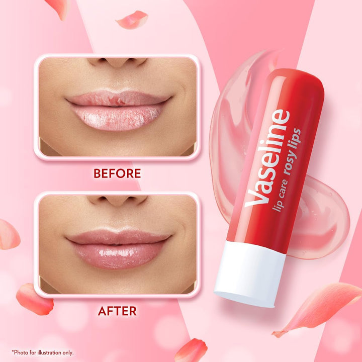 Vaseline Lip Therapy Rosy Lips Lip Balm With Pure Jelly & Light Rose Tint For Soft & Pink Lips| Nourishes & Protects Lips| Non-greasy Lip