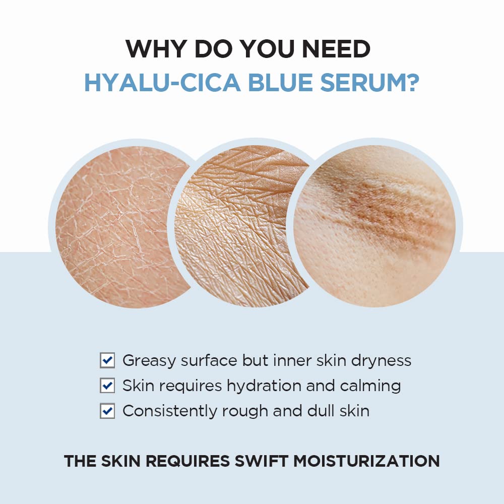 Hyalu-CICA Blue Serum 50ml| 5 Layer Hyaluronic Acid Cica Niacinamide | Hydrating and Refreshing Multi-Care Solutions
