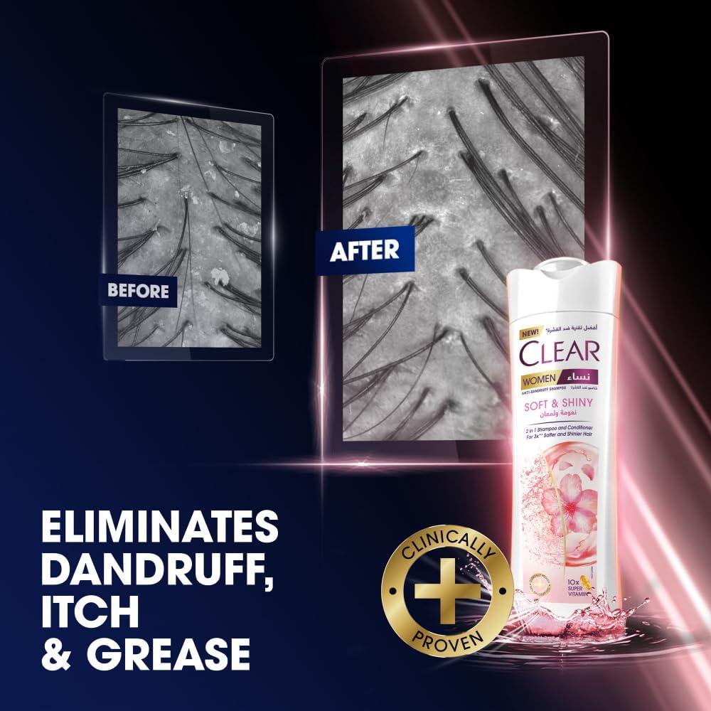 CLEAR 2in1 Shampoo & conditioner for women, anti dandruff shampoo, Soft & Shiny, for 3x** softer & shinier hair, 400ml