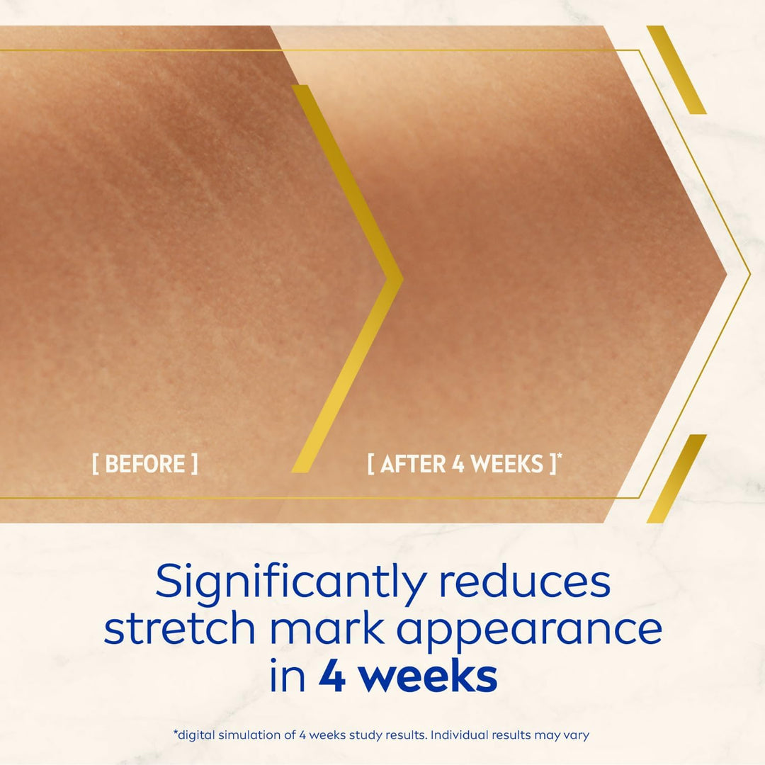 Nivea LUMINOUS 630 Marks and Spots Reduction Body Cream, Even Skin Tone, Reduced Visibility of Stretch Marks, Sun Blemishes