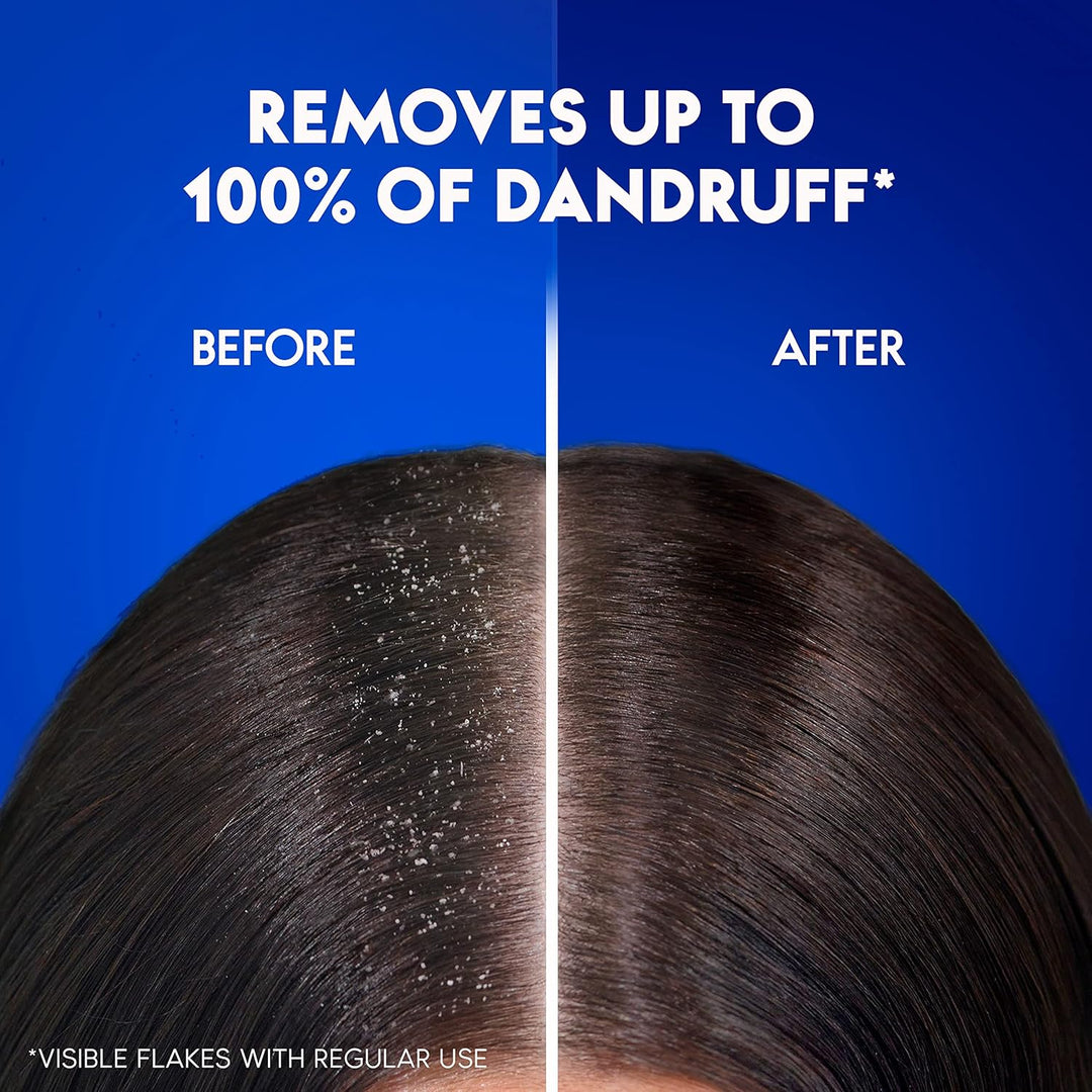 Head & Shoulders Daily Clean Anti-Dandruff Shampoo, with MaxFoam Technology Dandruff Won’t Come Back Ever, Clinically Proven, 400ml+400ml