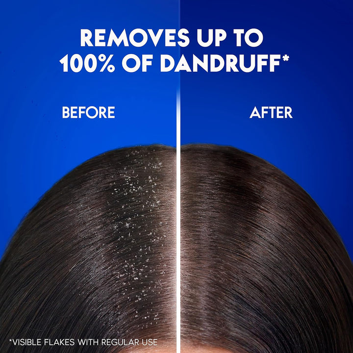 Head & Shoulders Daily Clean Anti-Dandruff Shampoo, with MaxFoam Technology Dandruff Won’t Come Back Ever, Clinically Proven, 400ml+400ml